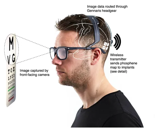 Gennaris Bionic Vision System